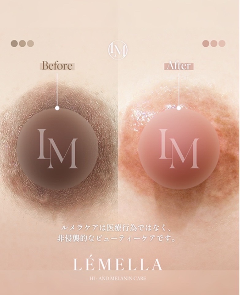 Menu6